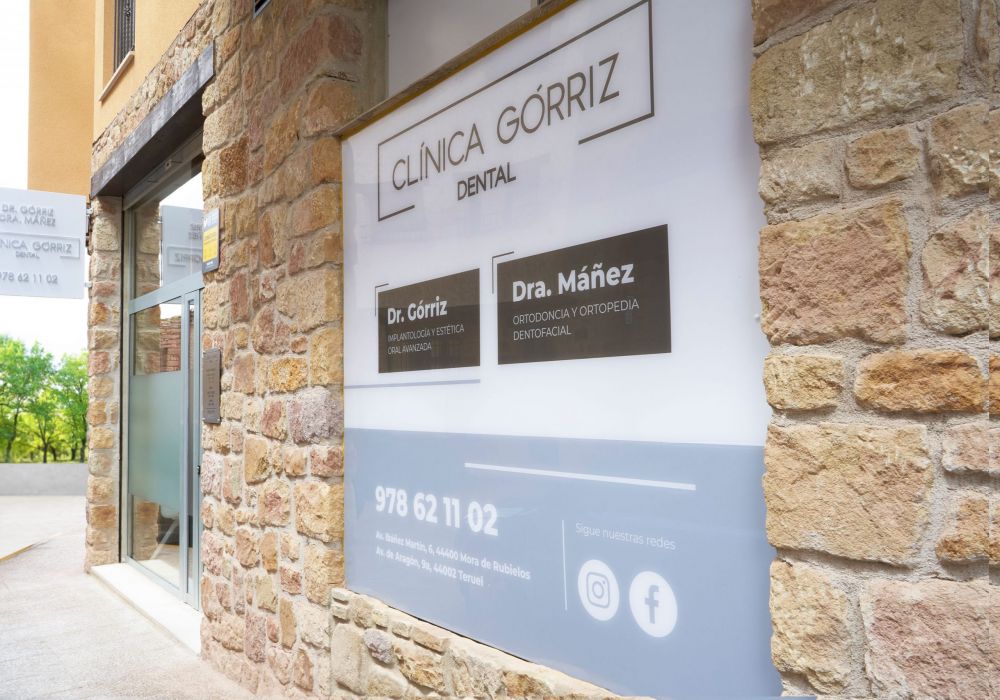 Clínica Górriz dentista Mora de Ruebielos - foto de la clínica